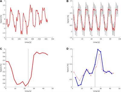 Improved localization of language areas using single voxel signal analysis of unprocessed fMRI data